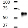 tumor_necrosis_f_511433463740c Tumor Necrosis Factor Receptor Proteins