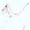 Norepinephrine Transporter-human  (NET17-1)