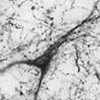 Serotonin Transporter-human  (ST51-1)